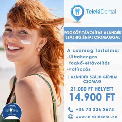 Fogkőeltávolítás Akció Fogkőeltávolítás Akció