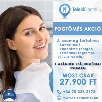 Fogtömés Akció Fogtömés Akció