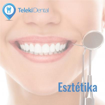 Cosmetic Dental Treatment!